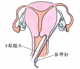 幼儿学画画，泉州捐卵宝宝学画画，学画画的好处，如何学画画